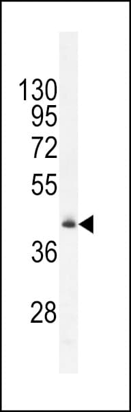 Polyclonal Rabbit anti-Human FAM82B Antibody (aa76-104, IHC, WB)