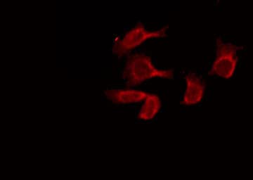 Polyclonal Rabbit anti-Human GABRB1 Antibody (IHC, IF, WB)
