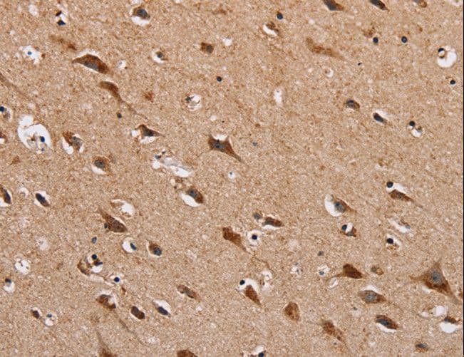 HTR3C / 5-HT3C Receptor Antibody