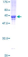 Human BRMS1 Protein (Recombinant GST)