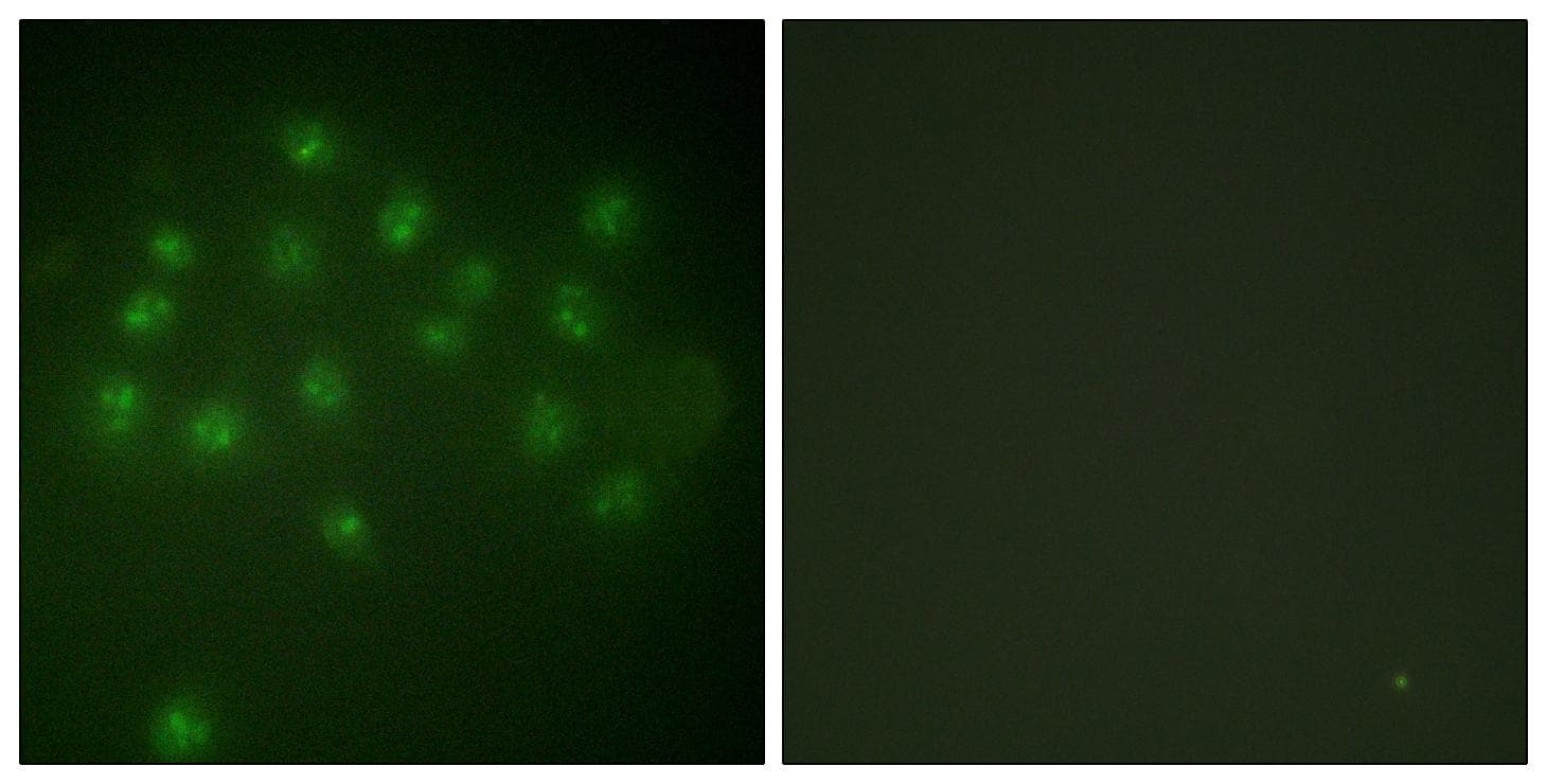 Polyclonal Rabbit anti-Human Vitamin D Receptor / VDR Antibody (phospho-Ser208, IF, WB)