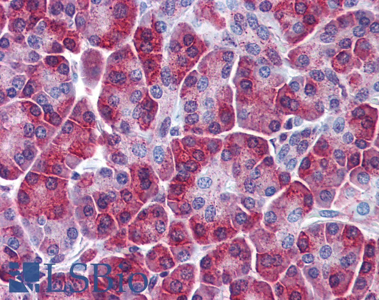 Polyclonal Rabbit anti-Human SQSTM1 Antibody (aa323-372, IHC, WB)