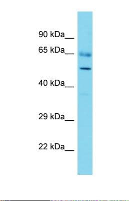 Polyclonal Rabbit anti-Human ADCK3 / CABC1 Antibody (aa472-521, WB)