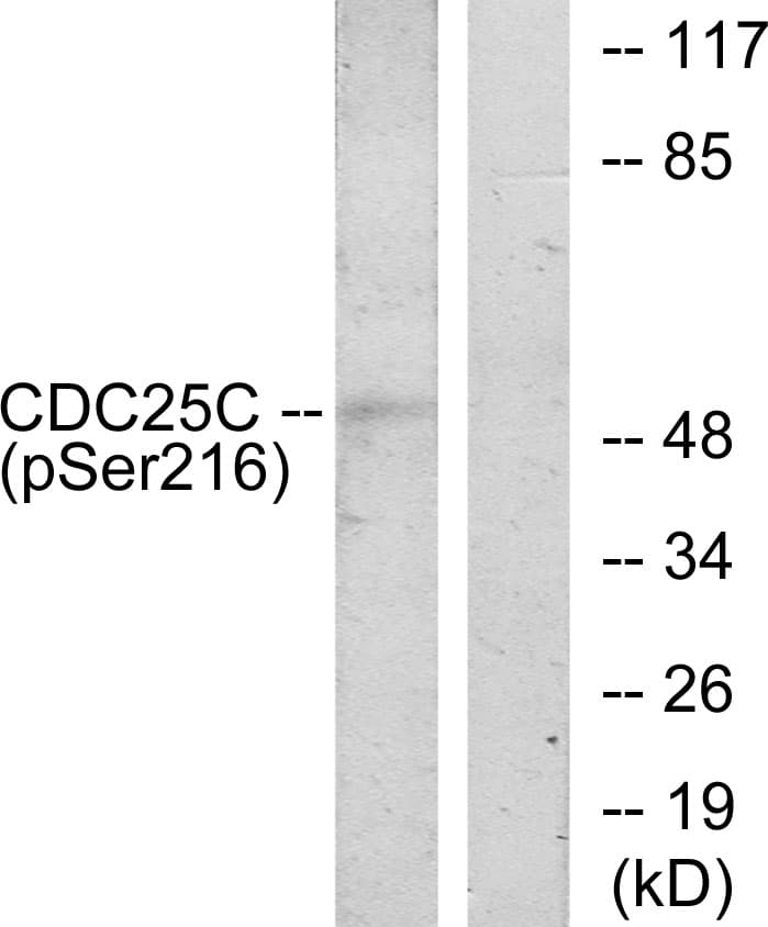 CDC25C Antibody (phospho-Ser216)