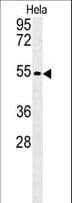 Polyclonal Rabbit anti-Human KLF17 Antibody (aa243-271, WB)