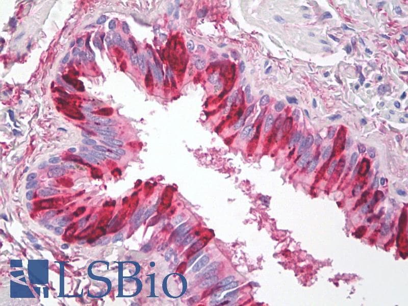 IHC-plus™ Monoclonal Mouse anti-Human SLPI / Antileukoproteinase Antibody (clone 31, IHC, WB)
