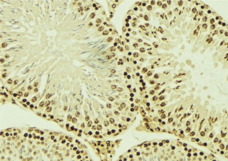 EMD / Emerin Antibody