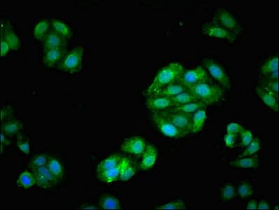FSCN1 / Fascin Antibody