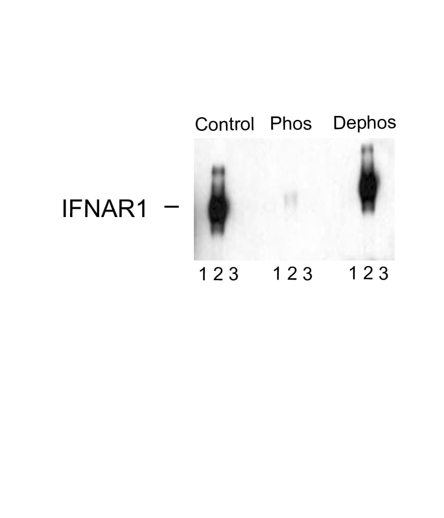 Polyclonal Rabbit anti-Human IFNAR1 / IFNAR Antibody (phospho-Ser535/Ser539, IHC, WB)