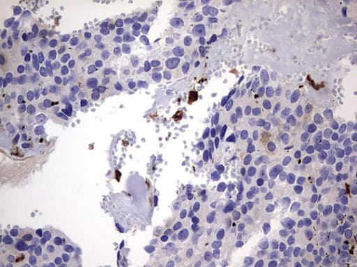 LGALS3 / Galectin 3 Antibody (clone OTI1C7)