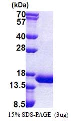 Human CARD17 / INCA Protein (Recombinant His)