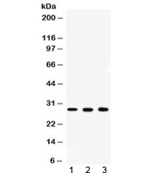 CA2 / Carbonic Anhydrase II Antibody