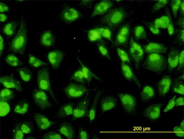 IHC-plus™ DHX9 Antibody (clone 3G7)