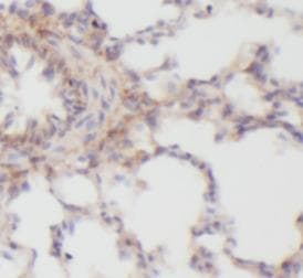 Polyclonal Rabbit anti-Human IL8 / Interleukin 8 Antibody (IHC, WB)