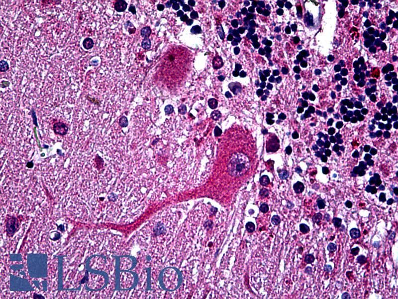 IHC-plus™ HTT / Huntingtin Antibody (clone 3F1)