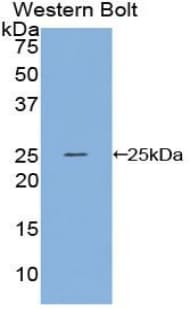 SPRY3 / Sprouty 3 Antibody (aa88-281, FITC)