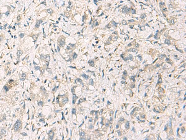 STX6 / Syntaxin 6 Antibody