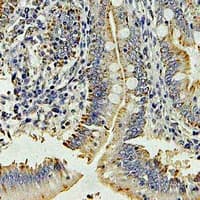 Polyclonal Rabbit anti-Human Dipeptidyl Peptidase 3 / DPP3 Antibody (IHC, WB)