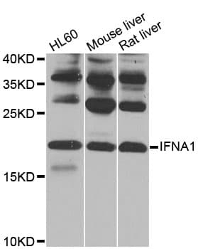 Polyclonal Rabbit anti-Human IFNA1 / Interferon Alpha 1 Antibody (IF, WB)