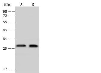 EXOSC4 / RRP41 Antibody
