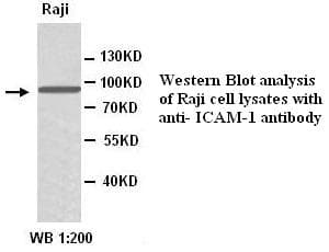Polyclonal Rabbit anti-Human ICAM-1 / CD54 Antibody (IHC, WB)