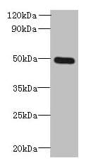 HTTY1 / TTYH1 Antibody