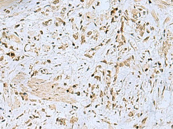 HOXC9 Antibody