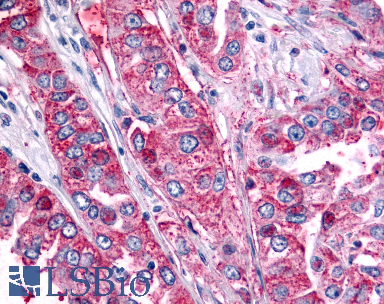 PathPlus™ Polyclonal Rabbit anti-Human ADGRB2 / BAI2 Antibody (C-Terminus, IHC)