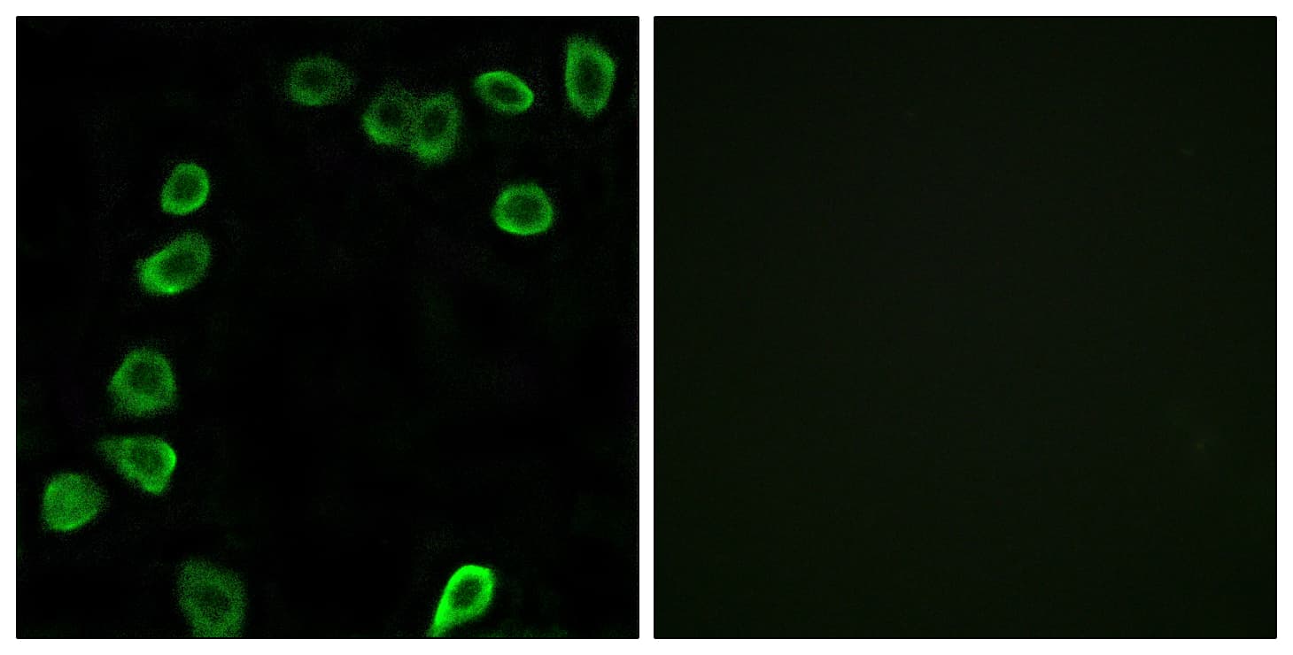 LAMA4 / Laminin Alpha 4 Antibody (aa481-530)