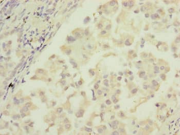 IF3mt / MTIF3 Antibody