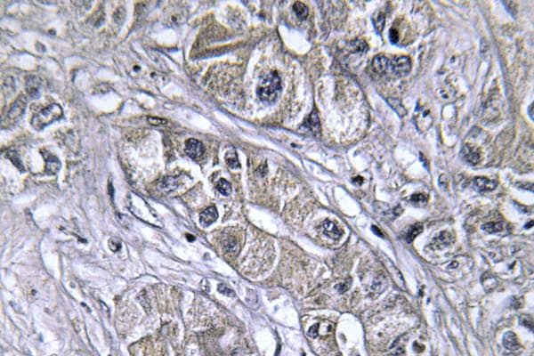 SERPINA5 / PCI Antibody (Leu291)