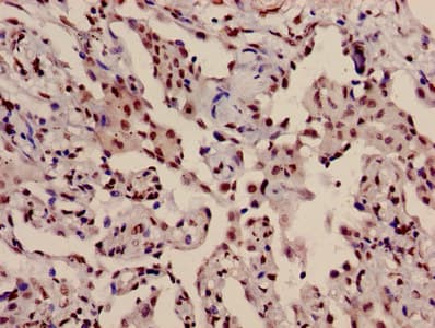 HIST1H3A Antibody