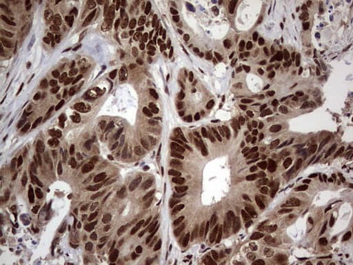 C14orf166 Antibody (clone OTI1E5)