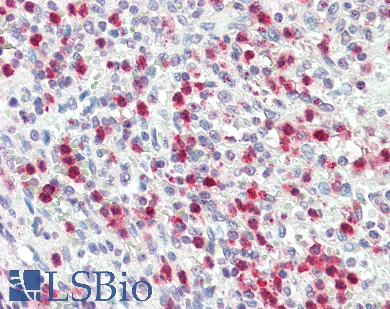 IHC-plus™ PRTN3 / Myeloblastin Antibody (aa88-98)