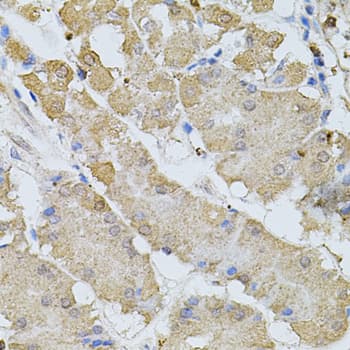 BEST1 / BEST / Bestrophin Antibody