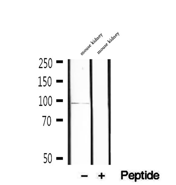 KIFC3 Antibody