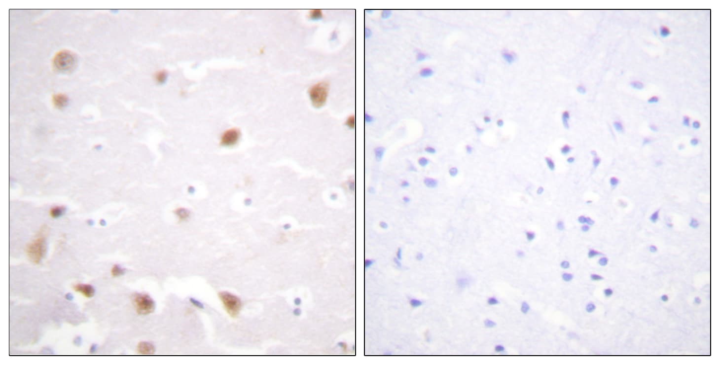 CSNK2B / Phosvitin Antibody (aa166-215)