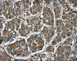 RDH11 Antibody (clone OTI1B4)