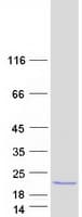 Human GLOD5 Protein (Recombinant Myc-DDK (Flag))