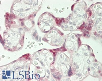 IHC-plus™ HMGB3 Antibody (aa125-175)