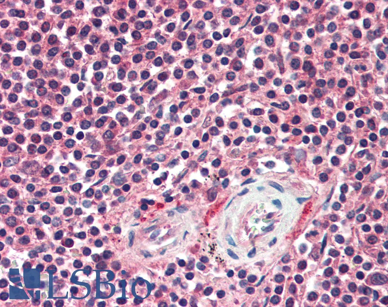 IHC-plus™ APAF1 / APAF-1 Antibody (C-Terminus)