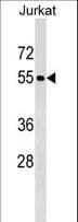 PNMA3 Antibody (aa384-412)