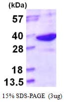 Human LHPP Protein (Recombinant His)