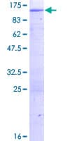 Human HK3 / Hexokinase 3 Protein (Recombinant GST)