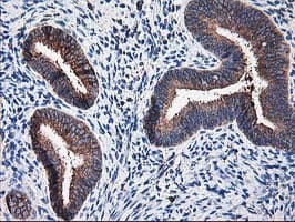 RPN1 / Ribophorin I Antibody (clone OTI3E1, Carrier-free)