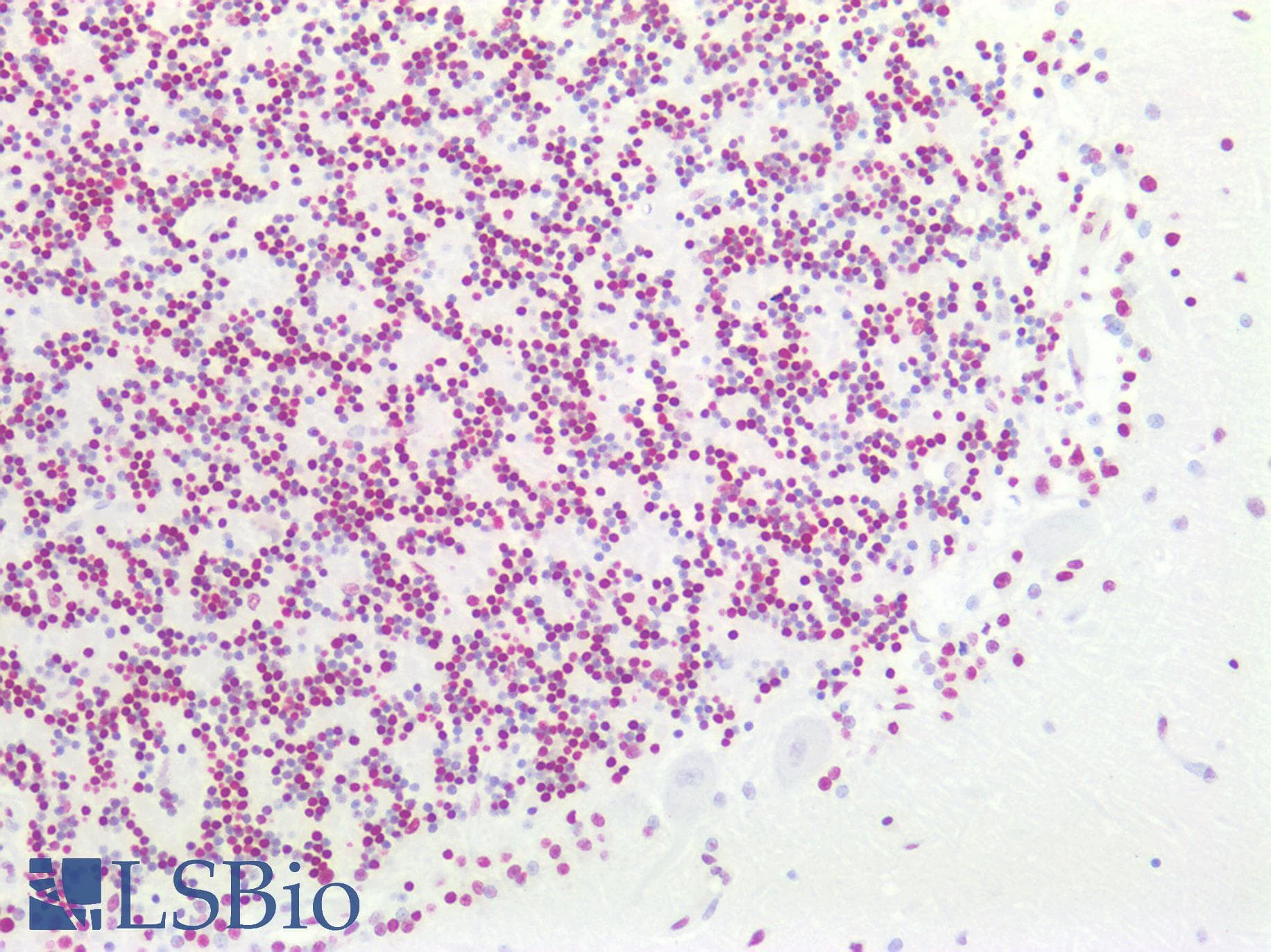 PathPlus™ HES5 Antibody