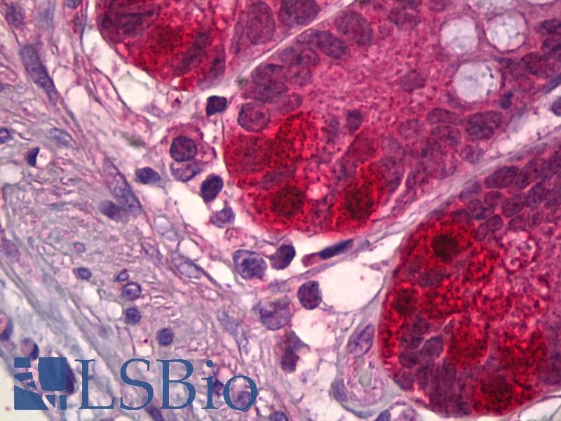 IHC-plus™ Polyclonal Rabbit anti-Human NEDD8 Antibody (aa10-59, IHC, WB)