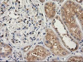 CAT / Catalase Antibody (clone 1B6, Carrier-free)