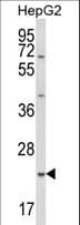 GSTA4 Antibody (aa62-90)
