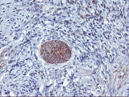 AGPAT5 Antibody (clone OTI1D12)